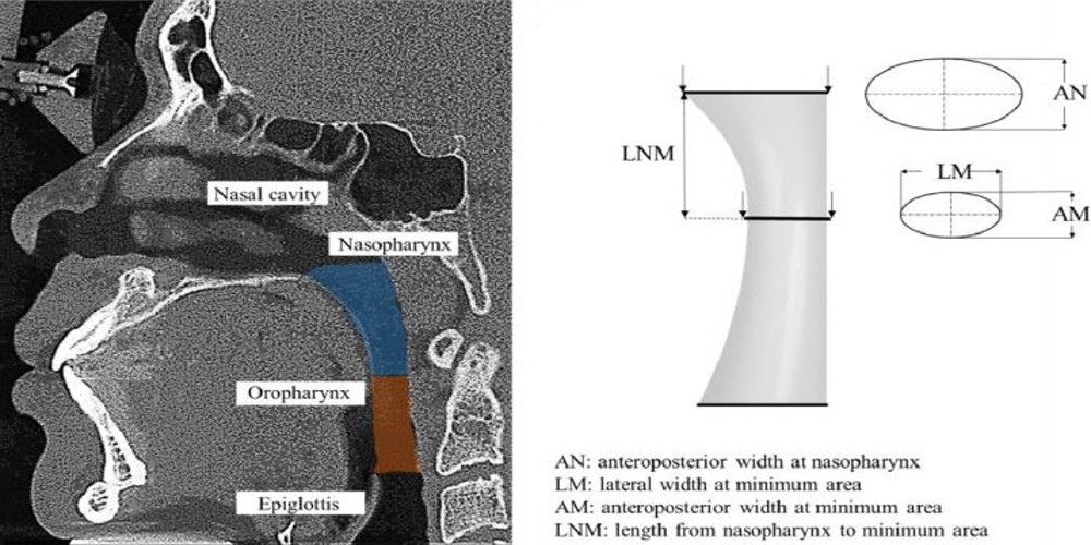 ▲3D UNet architecture를 통해 CT 영상에서 추출한 단순화된 기도 형상